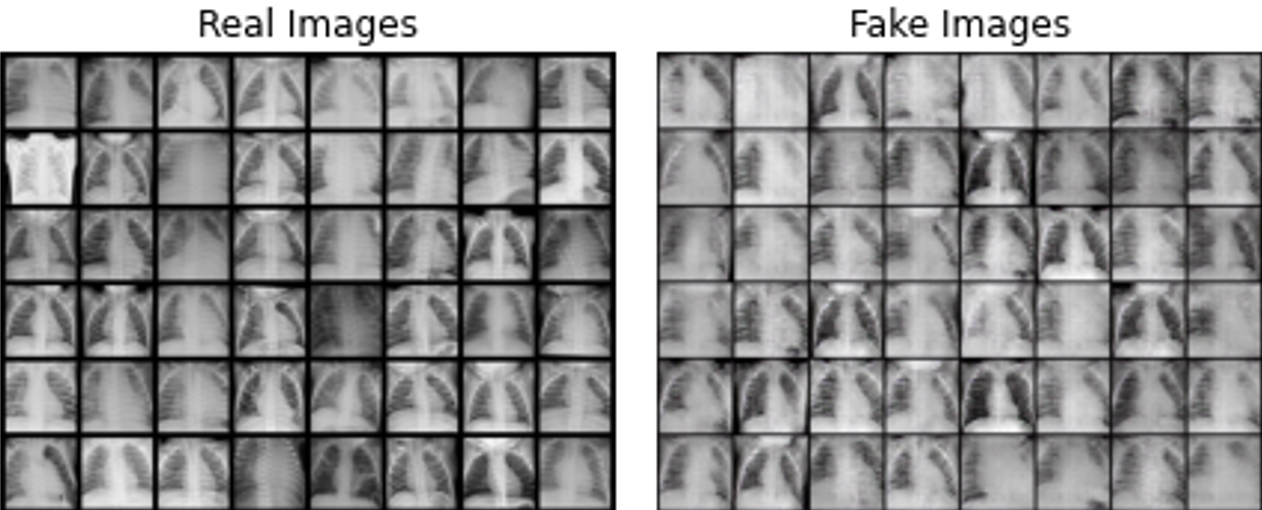 Deep-Fake medical image (X-ray) using GAN